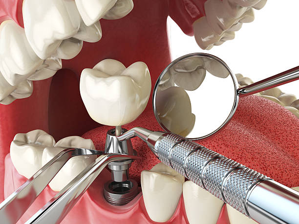Best Emergency Orthodontic Repairs in Mountain City, TN